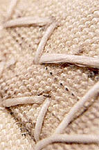 What Little Healthy Stitching Remains
